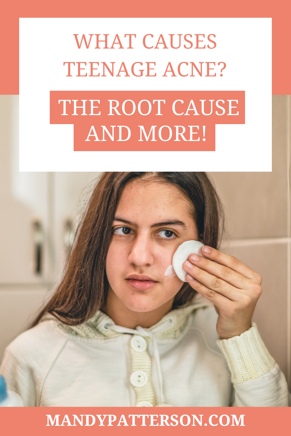 What Causes Teenage Acne? The Root Cause and More!